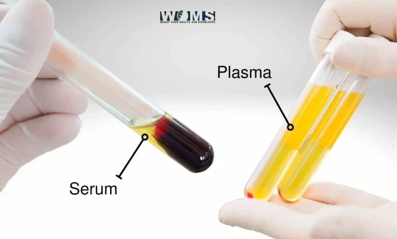 Serum vs Plasma