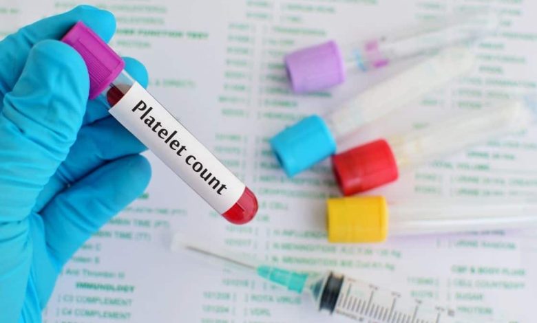 Normal Platelet Count