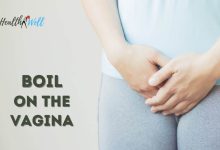 Boil on the Vagina