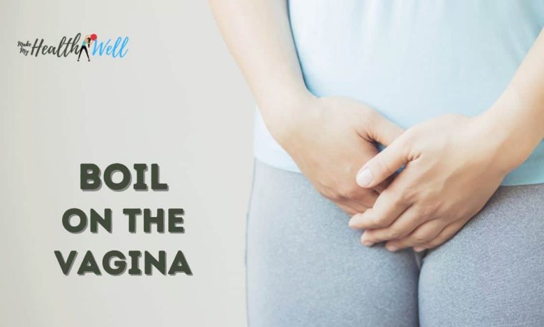 Boil on the Vagina