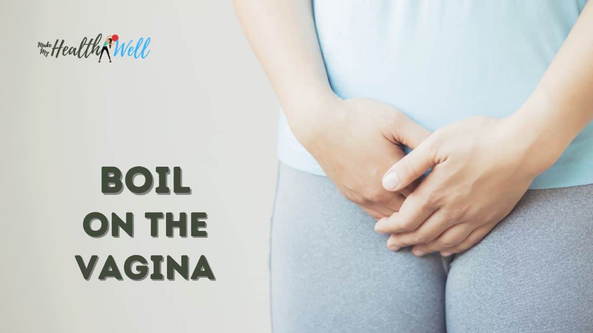 Boil On The Vagina Make My Health Well