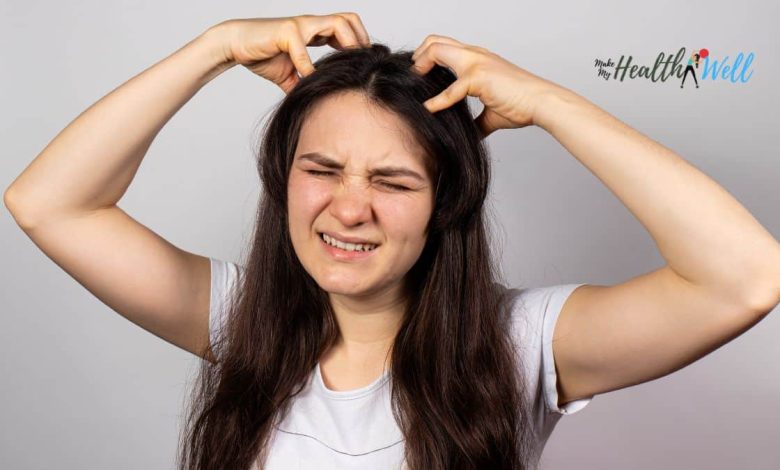 Is Dandruff Contagious